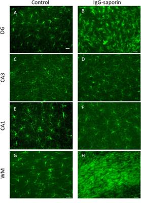 Cholinergic Deficit Induced by Central Administration of 192IgG-Saporin Is Associated With Activation of Microglia and Cell Loss in the <mark class="highlighted">Dorsal Hippocampus</mark> of Rats
